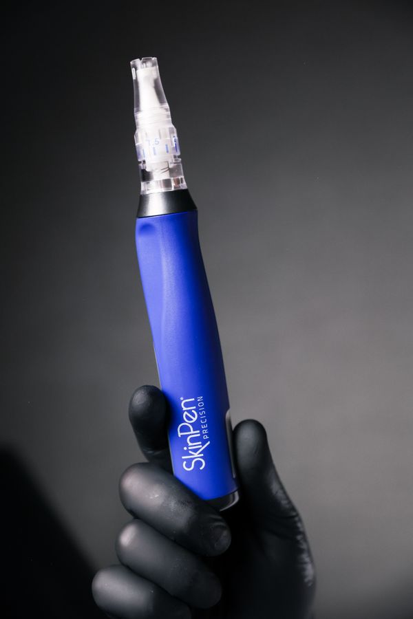 SkinPen-Microneedling-7.jpg